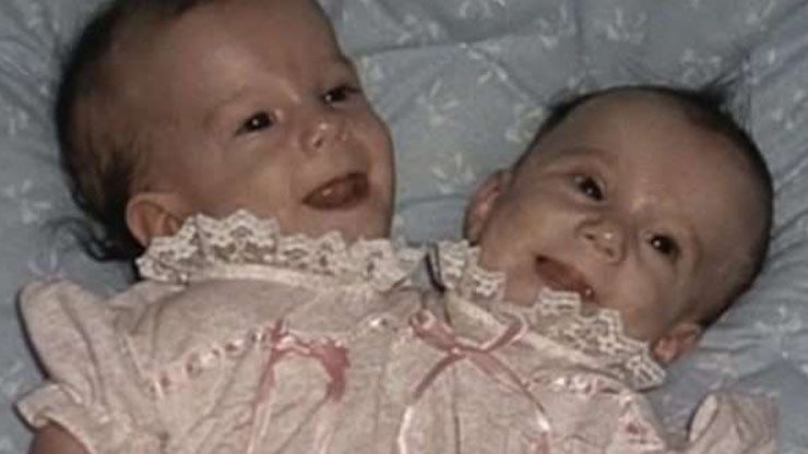 2 Abby And Brittany
