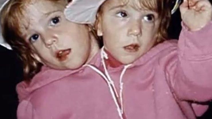 5 Abby And Brittany