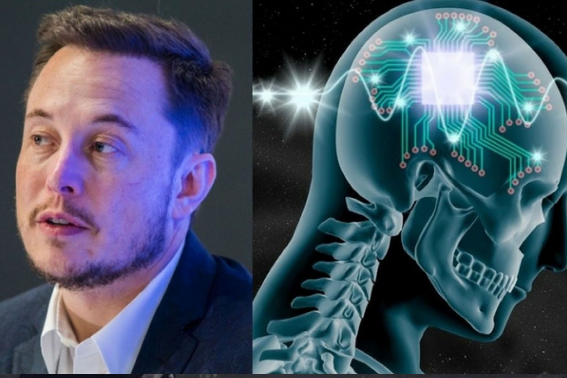 neuralink elon musk