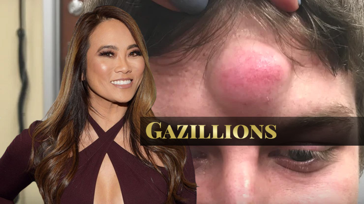 Dr. Pimple Popper Net Worth | A Look At Sandra Lee's Popular TLC Show
