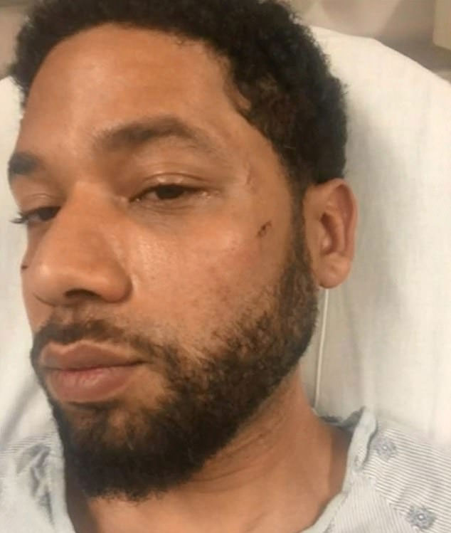 Jury says Jussie Smollett is GUILTY of hate crime hoax 2